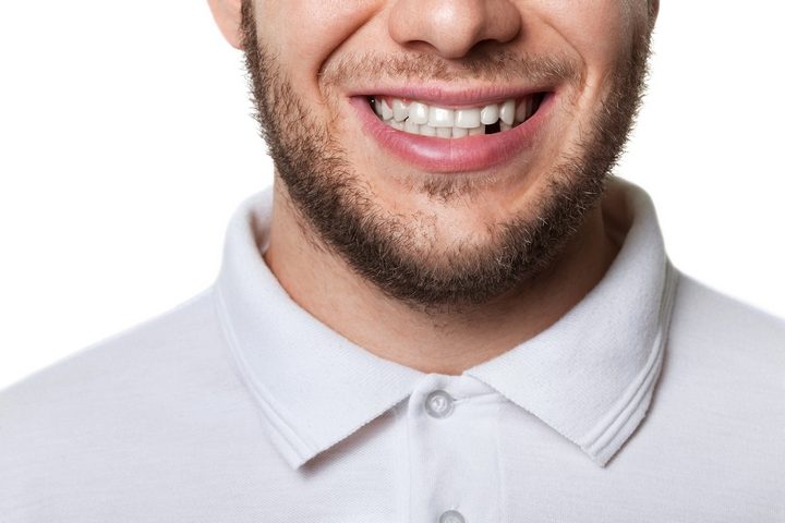 what are the different types of teeth humans have