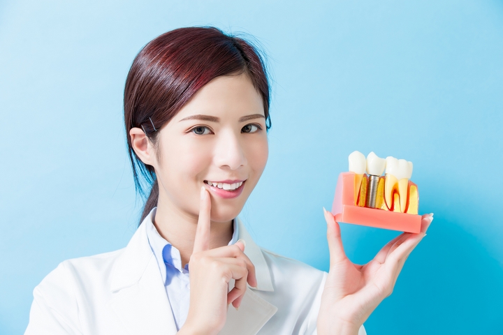 4 Things to Expect from Experts in Dental Implants
